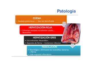 • Exudado proteinaceo ---- Rara vez identificable
• Eritrocitos exudado intraalveolar celular…
Neutrofilos
• Lisis eritrocitos. Neutrofilo+.
• Depositos de fibrina - Contension infeccion
• Macrofagos+, eliminacion de neutrofilos, bacterias
y fibrina
• Cede respuesta inflamatoria
 
