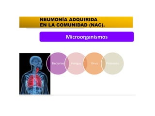 Bacterias Hongos Virus Protozoos
NEUMONÍA ADQUIRIDA
EN LA COMUNIDAD (NAC).
 