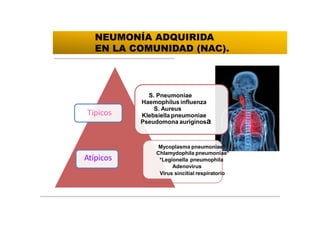 S. Pneumoniae
Haemophilus influenza
S. Aureus
Klebsiella pneumoniae
Pseudomona auriginosa
Mycoplasma pneumoniae*
Chlamydophila pneumoniae*
*Legionella pneumophila
Adenovirus
Virus sincitial respiratorio
Atípicos
Típicos
NEUMONÍA ADQUIRIDA
EN LA COMUNIDAD (NAC).
 
