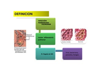)
INFECCIÓN
PARÉNQUIMA
PULMONAR
Lesion inflamatoria
pulmonar
R= llegada de MO
Viral, bacteriana,
parasitos, hongos
DEFINICION
 