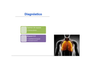 Examen de esputo
• Hemocultivos
Biopsia E.O.
• Cepillado bronquial
• Punción A.A.F.T.
 