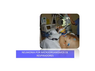 NEUMONIA POR MICROORGANISMOS DE
RESPIRADORES
 