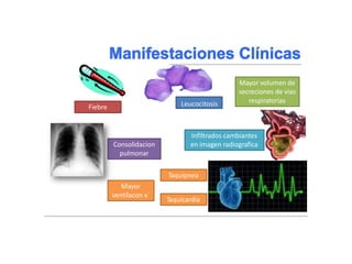 Braunwald, Eugene, and Tinsley Randolph Harrison. "NEUMONIA." Harrison: principios de medicina interna. Madrid:)
McGraw-Hill, 2002. 1619-1628. Impreso.
Fiebre
Mayor
ventilacon x`
Taquicardia
Taquipnea
Infiltrados cambiantes
Consolidacion en imagen radiografica
pulmonar
Mayor volumen de
secreciones de vias
Leucocitosis respiratorias
 