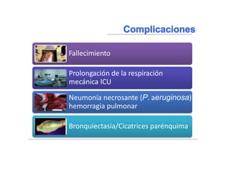 Braunwald, Eugene, and Tinsley Randolph Harrison. "NEUMONIA." Harrison: principios de medicina interna. Madrid:)
McGraw-Hill, 2002. 1619-1628. Impreso.
Fallecimiento
Prolongación de la respiración
mecánica ICU
Neumonía necrosante (P. aeruginosa)
hemorragia pulmonar
Bronquiectasia/Cicatrices parénquima
 