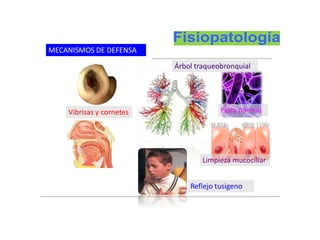 MECANISMOS DE DEFENSA
Vibrisas y cornetes
Reflejo tusigeno
Árbol traqueobronquial
Limpieza mucociliar
Flora normal
 