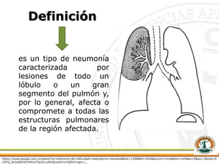 Definición
es un tipo de neumonía
caracterizada por
lesiones de todo un
lóbulo o un gran
segmento del pulmón y,
por lo gen...