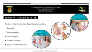 En niños es importante realizar diagnóstico diferencial con:
 Bronquitis
 Laringotraqueitis
 Asma bronquial
 Acidosis metabólica
 Cuerpo extraño en bronquios
OCTAVIO RIVERO SERRANO (2009), 6TA EDICIÓN, NEUMOLOGÍA/
KUMATE-GUTIERREZ (2013), 17MA INFECTOLOGÍA CLINICA
DIAGNÓSTICO DIFERENCIAL
UNIVERSIDAD AUTÓNOMA DE SINALOA
FACULTAD DE MEDICINA
HEPATITIS VIRAL
UNIVERSIDAD AUTÓNOMA DE SINALOA
FACULTAD DE MEDICINA
NEUMONÍA VIRAL
 