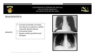 DIAGNOSTICO
IMAGEN
• Lesiones localizadas en la base,
solo afectan un segmento o lóbulo
y describe derrame pleural.
• Crecimiento hiliar
• Imagen nodular pseudotumoral
(benigna)
KUMATE J.[2008]. INFECTOLOGIA CLINICA. MÉXICO; MENDEZ EDITORES.
UNIVERSIDAD AUTÓNOMA DE SINALOA
FACULTAD DE MEDICINA
HEPATITIS VIRAL
UNIVERSIDAD AUTÓNOMA DE SINALOA
FACULTAD DE MEDICINA
NEUMONÍA POR MICOPLASMA
 