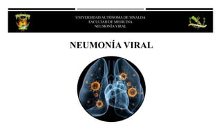 NEUMONÍA VIRAL
UNIVERSIDAD AUTÓNOMA DE SINALOA
FACULTAD DE MEDICINA
NEUMONÍA VIRAL
 