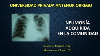 UNIVERSIDAD PRIVADA ANTENOR ORREGO
Marco A. Cornejo Cruz
Medico neumólogo HBT
NEUMONÍA
ADQUIRIDA
EN LA COMUNIDAD
 
