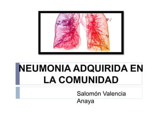 NEUMONIA ADQUIRIDA EN
LA COMUNIDAD
Salomón Valencia
Anaya
 