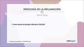E.	M.	Ashley	L.	Huerta	Martínez.			31	DE	AGOSTO		2021
PATOLOGÍA	DE	LA	INFLAMACIÓN	
Anatomía Patológica
4. Temas selectos de patología inflamatoria: Neumonía
 