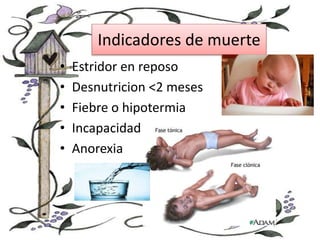 Indicadores de muerte
• Estridor en reposo
• Desnutricion <2 meses
• Fiebre o hipotermia
• Incapacidad
• Anorexia
 