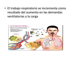• El trabajo respiratorio se incrementa como
resultado del aumento en las demandas
ventilatorias y la carga
 
