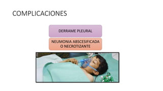 COMPLICACIONES
DERRAME PLEURAL
NEUMONIA ABSCESIFICADA
O NECROTIZANTE
 