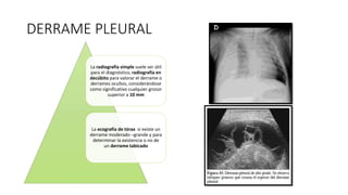 DERRAME PLEURAL
La radiografía simple suele ser útil
para el diagnóstico, radiografía en
decúbito para valorar el derrame o
derrames ocultos, considerándose
como significativo cualquier grosor
superior a 10 mm
La ecografía de tórax si existe un
derrame moderado –grande y para
determinar la existencia o no de
un derrame tabicado
 