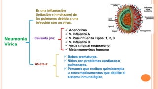 Neumonía
Vírica
Es una inflamación
(irritación e hinchazón) de
los pulmones debido a una
infección con un virus.
Causada por:
 Adenovirus
 V. Influenza A
 V. Parainfluenza Tipos 1, 2, 3
 V. Influenza B
 Virus sincitial respiratorio
 Metaneumovirus humano
Afecta a:
 Bebes prematuros.
 Niños con problemas cardiacos o
pulmonares.
 Personas que reciben quimioterapia
u otros medicamentos que debilite el
sistema inmunológico
 