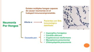 Neumonía
Por Hongos
Existen múltiples hongos capaces
de causar neumonías en el
huésped inmunocomprometido.
Afecta a:
Pacientes con Sist.
Inmunológico
debilitado
Causada por:
 Aspergillus fumigatus
 Candida albicans
 Cryptococcus neoformans
 Mycoplasma pneumoniae
 Chlamydophila pneumonie
 
