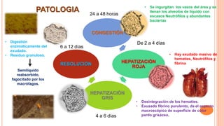 CONGESTIÓN
HEPATIZACIÓN
ROJA
HEPATIZACIÓN
GRIS
RESOLUCIÓN
4 a 6 días
De 2 a 4 días
24 a 48 horas
6 a 12 días
• Se ingurgitan los vasos del área y se
llenan los alveolos de liquido con
escasos Neutrófilos y abundantes
bacterias
• Hay exudado masivo de
hematíes, Neutrófilos y
fibrina
• Desintegración de los hematíes.
• Exusado fibrino purulento, da el aspecto
macroscópico de superficie de color
pardo grisáceo.
• Digestión
enzimáticamente del
exudado.
• Residuo granuloso.
Semilíquido
reabsorbido,
fagocitado por los
macrófagos.
PATOLOGIA
 