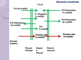 Neumonía complicada
                              1-5 ml

    P.H 30 cmH2O
                                                           P.H Plasmática
                                                            11 cmH2O
                            P. I Negativa
                             5 cmH2O
                                                           P.O Plasmática
P.O Plasmática                                              32 cmH2O
 32 cmH2O
                                P.O
                                6 cmH2O

                            Presión neta                    Presión neta
                            9 cmH2O                         10 cmH2O

Drenaje
linfático
.
                 Pleural     Espaci         Pleural
                 Parietal    o              Visceral
                             Pleural
 