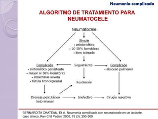 Neumonía complicada

          ALGORITMO DE TRATAMIENTO PARA
                  NEUMATOCELE




BERNARDITA CHATEAU, Et al. Neumonía complicada con neumatocele en un lactante,
caso clínico. Rev Chil Pediatr 2008; 79 (3): 295-300
 