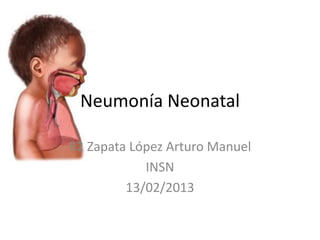Neumonía Neonatal

R2 Zapata López Arturo Manuel
            INSN
         13/02/2013
 