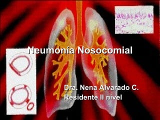 Neumonía Nosocomial Dra. Nena Alvarado C. Residente II nivel 