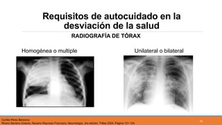 Requisitos de autocuidado en la
desviación de la salud
RADIOGRAFÍA DE TÓRAX
Homogénea o multiple Unilateral o bilateral
Cortés Pérez Berenice
Rivero Serrano Octavio, Navarro Reynoso Francisco, Neumología, 3ra edición, Trillas 2004, Página 121-124
25
 