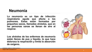 Neumonía
La neumonía es un tipo de infección
respiratoria aguda que afecta a los
pulmones. Estos están formados por
pequeños sacos, llamados alvéolos, que en
las personas sanas se llenan de aire al
respirar.
Los alvéolos de los enfermos de neumonía
están llenos de pus y líquido, lo que hace
dolorosa la respiración y limita la absorción
de oxígeno.
ROMERO URIBE OLYMPIA NATALY
Página OMS consultada 2017
6
 