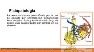 Fisiopatología
La neumonía clásica (ejemplificada por la que
es causada por Streptococcus pneumoniae)
tiene un patron lobar y evoluciona a lo largo de
cuatro fases caracterizadas por cambios en los
alveolos.
ROMERO URIBE OLYMPIA NATALY
Dan L. Longo. Anthony S. Fauci. HARRISON. MANUAL DE MEDICINA. 18° e Ed. México: F.McGRAW-HILL INTERAMERICANA EDITORES; 2013.
9
 