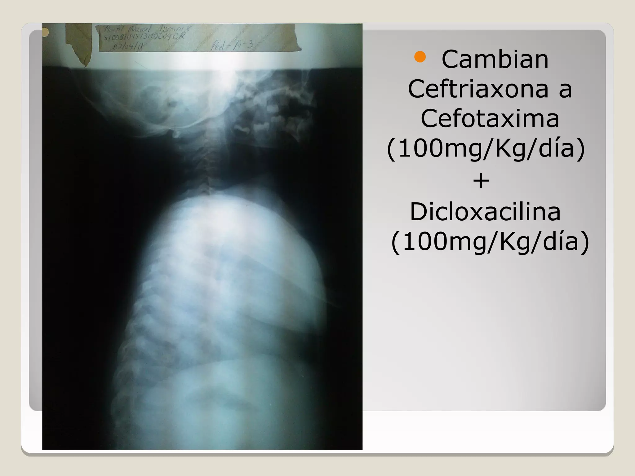   Cambian
  Ceftriaxona a
   Cefotaxima
(100mg/Kg/día)
       +
  Dicloxacilina
(100mg/Kg/día)
 