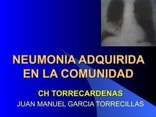 NEUMONIA ADQUIRIDA EN LA COMUNIDAD CH TORRECARDENAS JUAN MANUEL GARCIA TORRECILLAS 