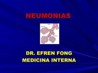 NEUMONIASNEUMONIAS
DR. EFREN FONGDR. EFREN FONG
MEDICINA INTERNAMEDICINA INTERNA
 