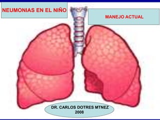 NEUMONIAS EN EL NIÑO
MANEJO ACTUAL
DR. CARLOS DOTRES MTNEZ
2008
 