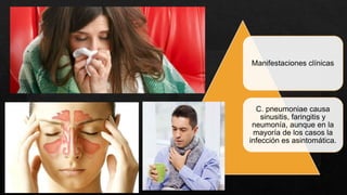 Manifestaciones clínicas
C. pneumoniae causa
sinusitis, faringitis y
neumonía, aunque en la
mayoría de los casos la
infección es asintomática.
 