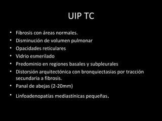 UIP TC
• Fibrosis con áreas normales.
• Disminución de volumen pulmonar
• Opacidades reticulares
• Vidrio esmerilado
• Predominio en regiones basales y subpleurales
• Distorsión arquitectónica con bronquiectasias por tracción
secundaria a fibrosis.
• Panal de abejas (2-20mm)
• Linfoadenopatías mediastínicas pequeñas.
 