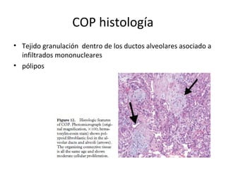 COP histología
• Tejido granulación dentro de los ductos alveolares asociado a
infiltrados mononucleares
• pólipos
 