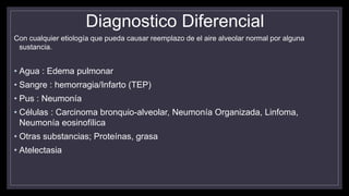 Diagnostico Diferencial
Con cualquier etiología que pueda causar reemplazo de el aire alveolar normal por alguna
sustancia.
• Agua : Edema pulmonar
• Sangre : hemorragia/Infarto (TEP)
• Pus : Neumonía
• Células : Carcinoma bronquio-alveolar, Neumonía Organizada, Linfoma,
Neumonía eosinofílica
• Otras substancias; Proteínas, grasa
• Atelectasia
 