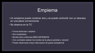 Empiema
• Un empiema puede contener aire y se puede confundir con un absceso
en una placa convencional.
• Se observa en la TC
• Forma lenticular o elíptica
• Son localizados
• Bordes lisos uniformes BIEN DEFINIDOS
• Con contraste realzan los bordes de la pleura parietal y visceral
• Puede observarse mayor atenuación de grasa extrapleural
 