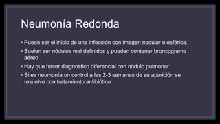 Neumonía Redonda
• Puede ser el inicio de una infección con imagen nodular o esférica.
• Suelen ser nódulos mal definidos y pueden contener broncograma
aéreo
• Hay que hacer diagnostico diferencial con nódulo pulmonar
• Si es neumonía un control a las 2-3 semanas de su aparición se
resuelve con tratamiento antibiótico
 