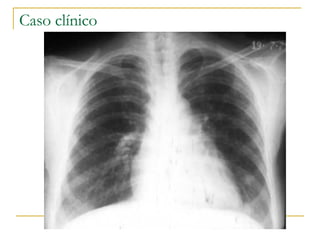 Caso clínico 