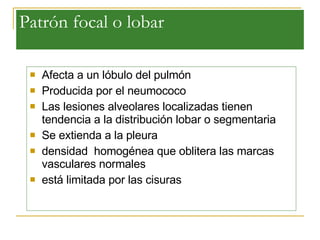 Patrón focal o lobar Afecta a un lóbulo del pulmón   Producida por el neumococo   Las lesiones alveolares localizadas tienen tendencia a la distribución lobar o segmentaria Se extienda a la pleura   densidad  homogénea que oblitera las marcas vasculares normales   está limitada por las cisuras  