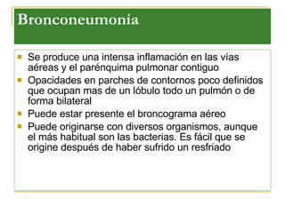Bronconeumonía   Se produce una intensa inflamación en las vías aéreas y el parénquima pulmonar contiguo Opacidades en parches de contornos poco definidos que ocupan mas de un lóbulo   todo un pulmón o de forma bilateral   Puede estar presente el broncograma aéreo   Puede originarse con diversos organismos, aunque el más habitual son las bacterias. Es fácil que se origine después de haber sufrido un resfriado   