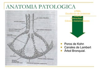 ANATOMIA PATOLOGICA Poros de Kohn  Canales de Lambert Árbol Bronquial. LPMN, Exudación de proteínas Edema Eritrocitos y  Células mononucleares  