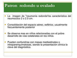 Patron  redond o u ovalado   La  imagen de "neumonía redonda"es característica del neumococo   2  o 2.5  cm . Consolidación del espacio aéreo, esférico, usualmente frecuentemente posterior Se observa mas  en niños   relacionadas con el pobre desarrollo de vías colaterales en los niños.  Pueden confundirse con masas mediastinales o intraparenquimatosas, siendo la presentación clínica la clave del diagnóstico.   