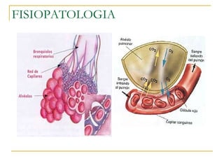 FISIOPATOLOGIA 