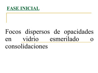 FASE INICIAL Focos dispersos de opacidades en vidrio esmerilado o consolidaciones  