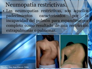 Restrictivas: Son provocadas por procesos que limitan la expansión pulmonar, produciendo una reducción real del volumen del aire inspirado, como sucede en el fibrotorax, las enfermedades neuromusculares, la cifosis, la escoliosis.la espondilitis o la recepción quirúrgica del tejido pulmonar. Neumopatía restrictivas.Las neumopatías restrictivas, son aquellos padecimientos caracterizados por la incapacidad del pulmón para expandirse por completo como resultado de una restricción extrapulmonar o pulmonar. 