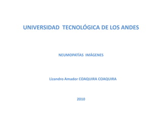 UNIVERSIDAD  TECNOLÓGICA DE LOS ANDES NEUMOPATÍAS  IMÁGENES Lizandro Amador COAQUIRA COAQUIRA 2010 
