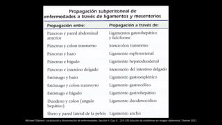 Michael Oliphant. Localización y diseminación de enfermedades. Sección II. Cap. 6 . 119-139.Solución de problemas en imagen abdominal. Elseiver 2011
 